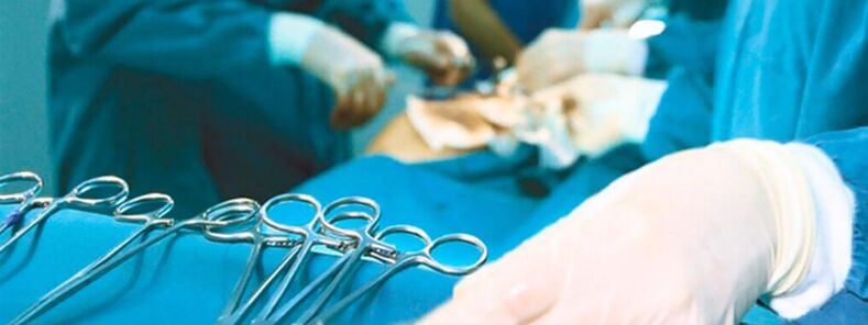 Cirugía de agrandamiento del pene realizada por un cirujano