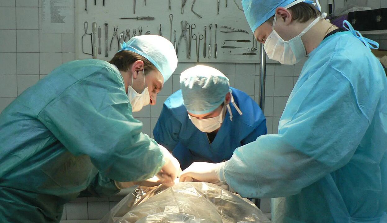 La cirugía es una forma costosa de agrandar el pene. 
